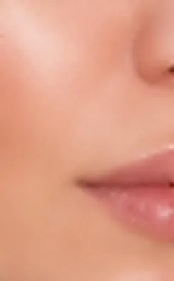Mejilla después del tratamiento de rejuvenecimiento facial