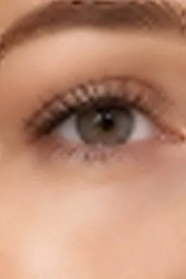 Contorno de ojos después del tratamiento de rejuvenecimiento facial